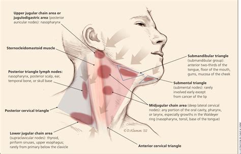 Swelling Of Lymph Nodes In Neck