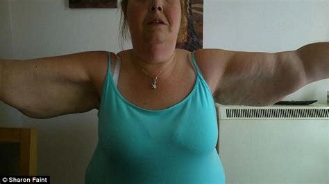 morbidly obese woman who lost 18 stone reveals her saggy skin daily mail online