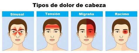Lo Que Los Dolores De Cabeza Revelan Sobre Tu Salud Headache Types