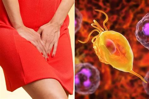 Super Gonorrhoea At Risk Of Becoming Untreatable Experts Warn