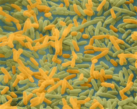 Coloured Sem Of Escherichia Coli Bacteria Stock Image B2300145