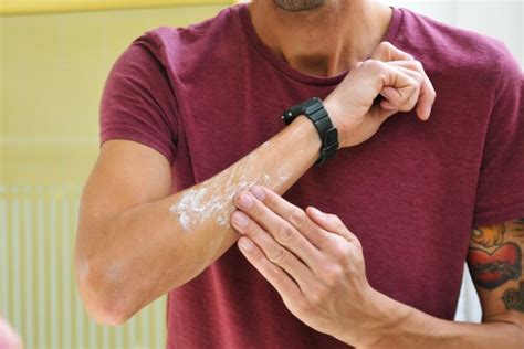 How To Get Rid Of Acne On Your Arms