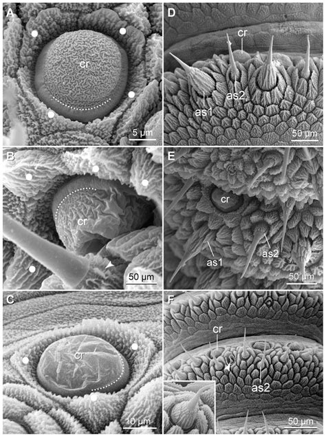 Scanning Electron Micrographs Of Sensory Structures On The Antennal Download Scientific Diagram