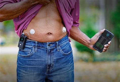 Ask About Insulin Pump Therapy Medtronic Diabetes
