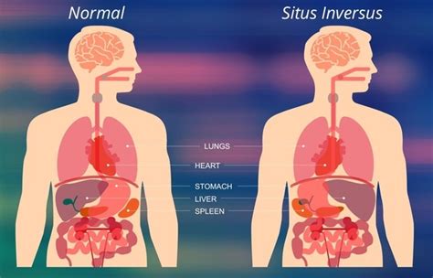 What Organs Are On The Right Side Of Your Back Quora
