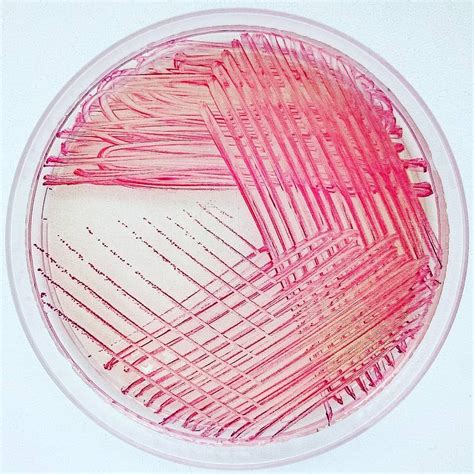Enterococcus Faecalis Enterococcus Agar Microbiology Petri Dish Agar