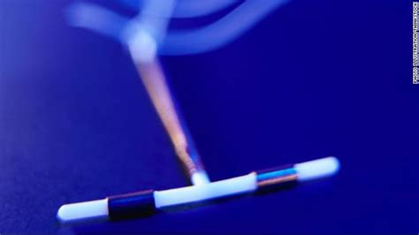 Iuds Implants Vastly More Effective Than The Pill Cnn