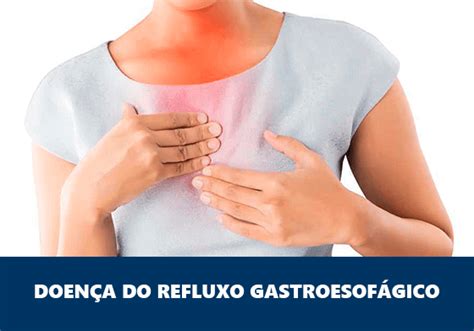 doenÇa do refluxo gastroesofÁgico guia saúde cidades
