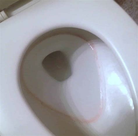 Pink Ring Stains In Toilet Bowls Causes And Remove