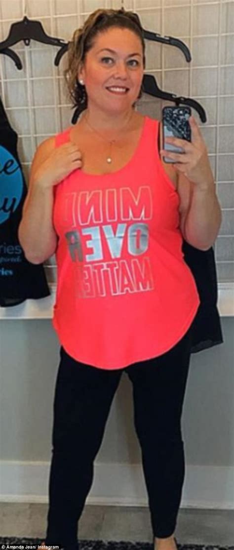 Canadian Mom Shows Off Loose Skin After Losing 150lbs Daily Mail Online