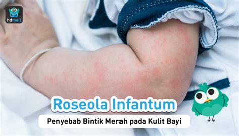 Roseola Infantum Penyebab Bintik Merah Pada Kulit Bayi Hdmall