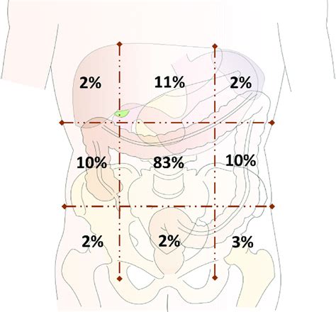 Location Of Abdominal Pain In Patients With Cf