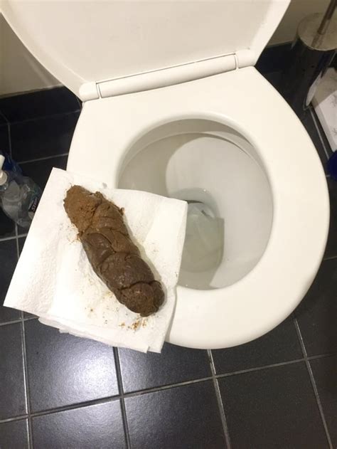 Normal 3 Day Poo Big Diameter With A Spot Of Blood Ratemypoo