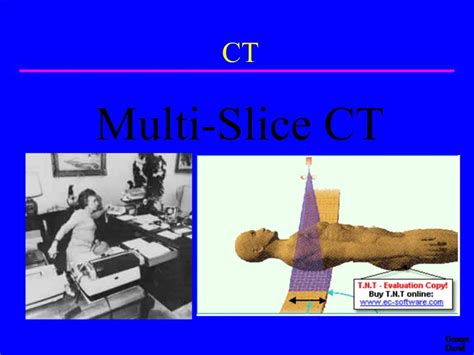Ppt Multi Slice Ct Powerpoint Presentation Free Download Id760864