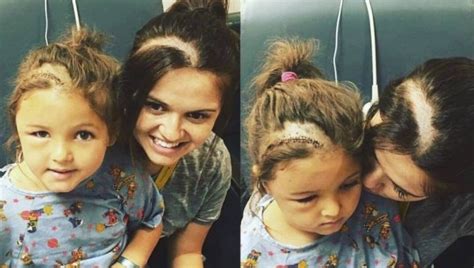 Mum Shaves Her Head To Match Her Daughters Brain Surgery Scar Stuff