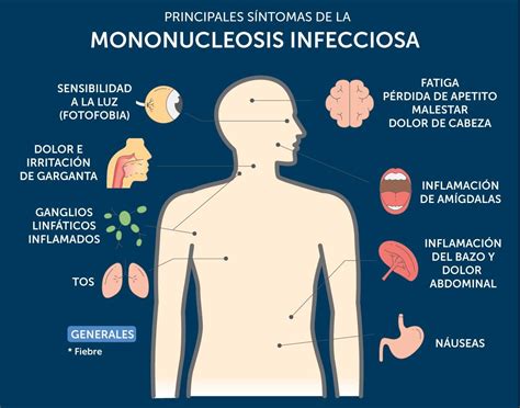 Mononucleosis causas síntomas prevención y tratamiento Hot Sex Picture