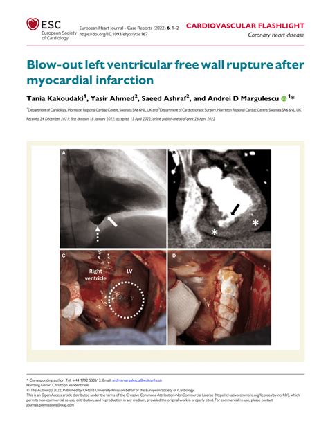 Pdf Blow Out Left Ventricular Free Wall Rupture After Myocardial