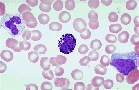Veterinary Hematology Dextervet There Is A Basophil In The Center Of