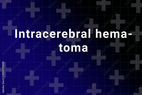 Intracerebral Hematoma Disease Illustration Intracerebral Hematoma