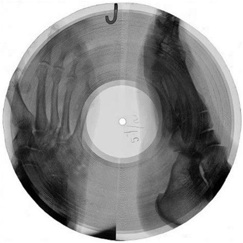 Soviet Era Bootleg Records Pressed On Discarded X Rays Bones Music