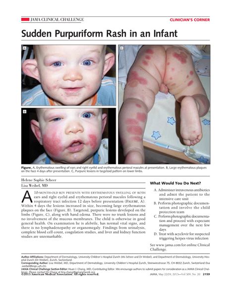 Sudden Purpuriform Rash In An Infant Dermatology Jama Jama Network