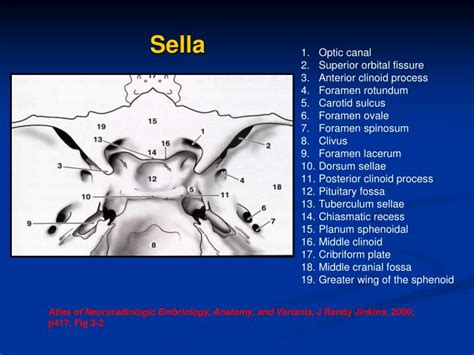 Ppt Sella Turcica And Parasellar Region Powerpoint Presentation Id