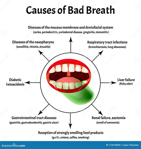 causes of bad breath halitosis the structure of the teeth and oral cavity diseases of the