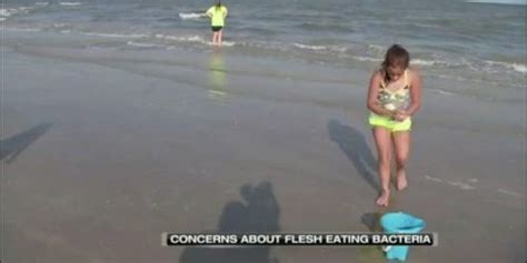 Beachgoers Concerned About Flesh Eating Bacteria