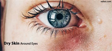 Dry Skin Around Eyes Causes And Home Remedies