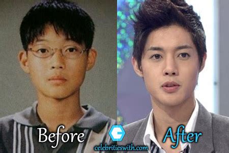 Well, when we talk about the korean actors, one actor we cannot forget is hyun bin. Kim Hyun Joong Plastic Surgery: Nose-Eyelid Surgery ...