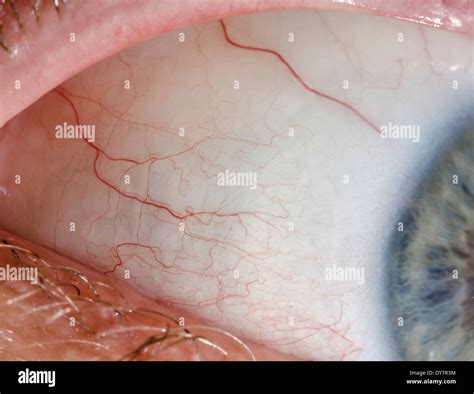 Eyeball Closeup Macro Of The Sclera And Veins Of A White Mans Eyeball