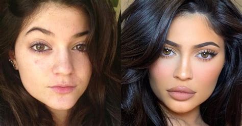 Kylie Jenner Transformation Photos How The Kuwtk Star Has Changed