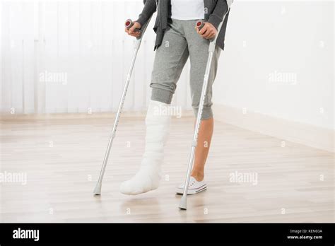 Leg Cast Crutches Stock Photos And Leg Cast Crutches Stock Images Alamy