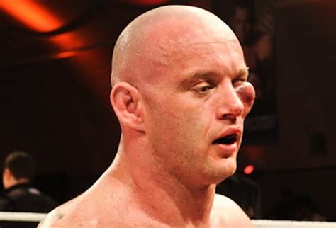 Top 20 Worst Eye Injuries In Mma History