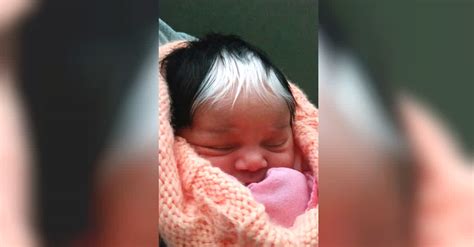 Baby Girl Is Born With Incredible Streak Of White Hair Exactly Like Her