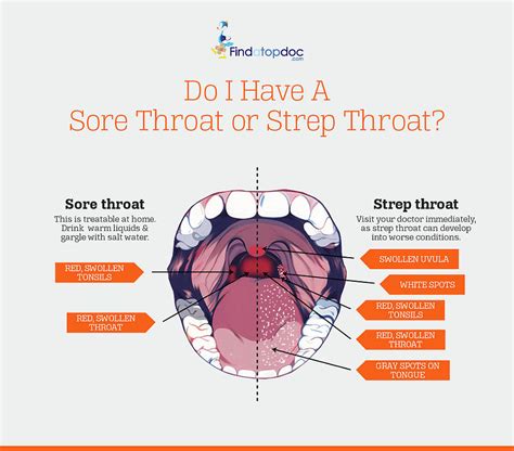Do I Have A Sore Throat Or Strep Throat Photograph By Finda Topdoc