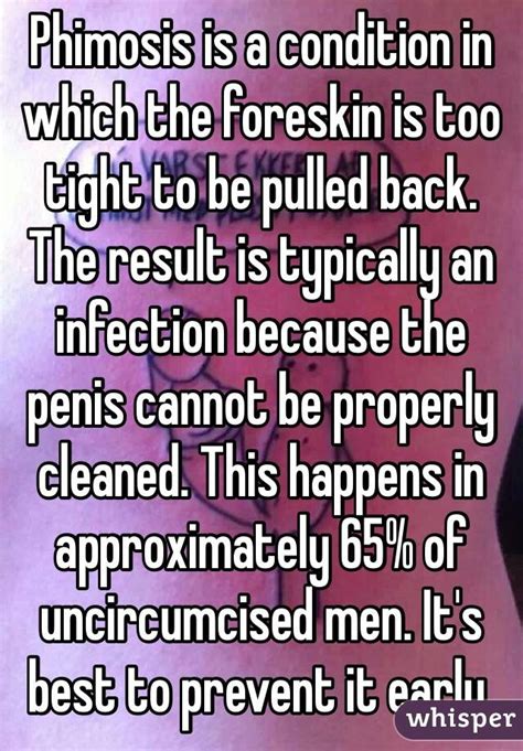 Phimosis Is A Condition In Which The Foreskin Is Too Tight To Be Pulled
