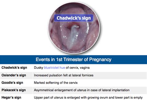 Rapid Review Events In 1st Trimester Of Pregnancy