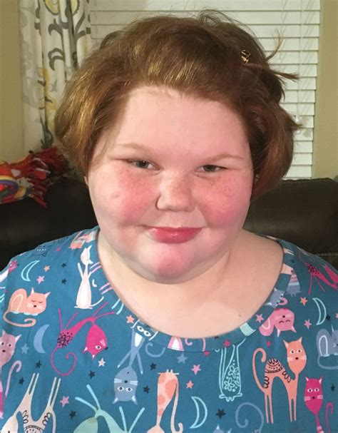 Alexis Shapiro Texas Girl Who Faced Extreme Weight Gain Is Doing Well Says Mom Her Tumor