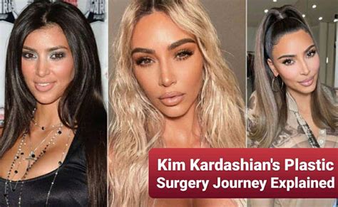 Kim Kardashian Before And After Looks The Socialite S Plastic Surgery