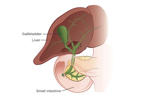 Gallbladder Cancer Memorial Sloan Kettering Cancer Center