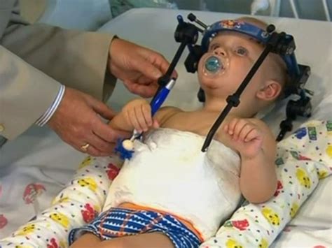 Doctors Reattach Toddlers Head To Spine After Car Crash Daily Telegraph