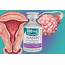 New Standard In Recurrent Platinum Sensitive Ovarian Cancer  Clearity