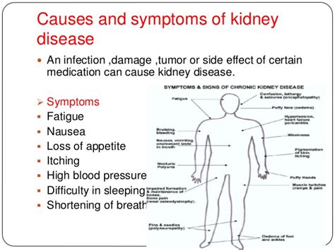 Related Keywords And Suggestions For Kidney Infection Symptoms