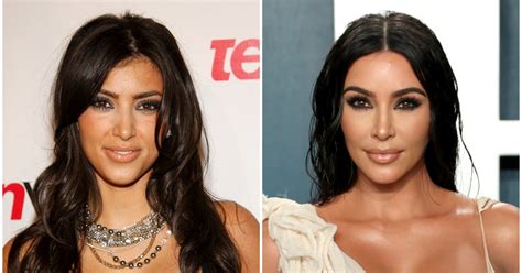 Kim Kardashian Before And After Plastic Surgery Timeline