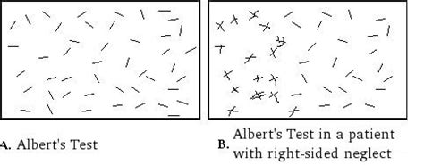 Clinical setting to test for spatial neglect. Line Bisection Test Printable : Spatial Neglect Practical ...