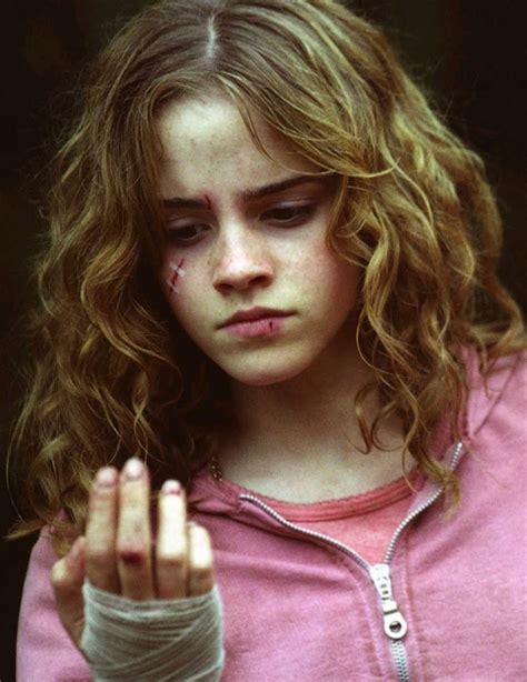 Emma Watson Prisoner Of Azkaban Orthopole