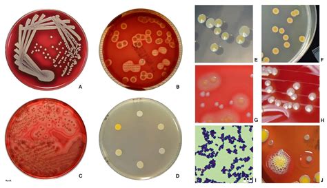 Staphylococcus Aureus Colony Morphology