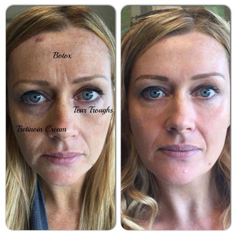 “im A Before Picture“ Deconstructing Spectacular Treatment Results