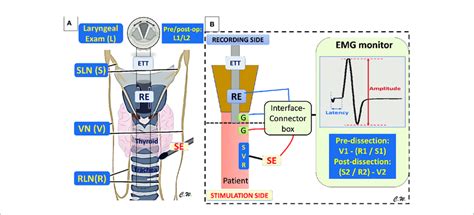 The Basic Laryngeal Nerve Anatomyelectrophysiology And Standard